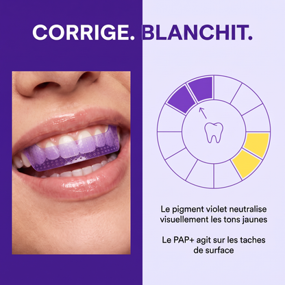 HISMILE Bandes de Blanchiment Dentaire V34 + PAP+ – 14 Applications